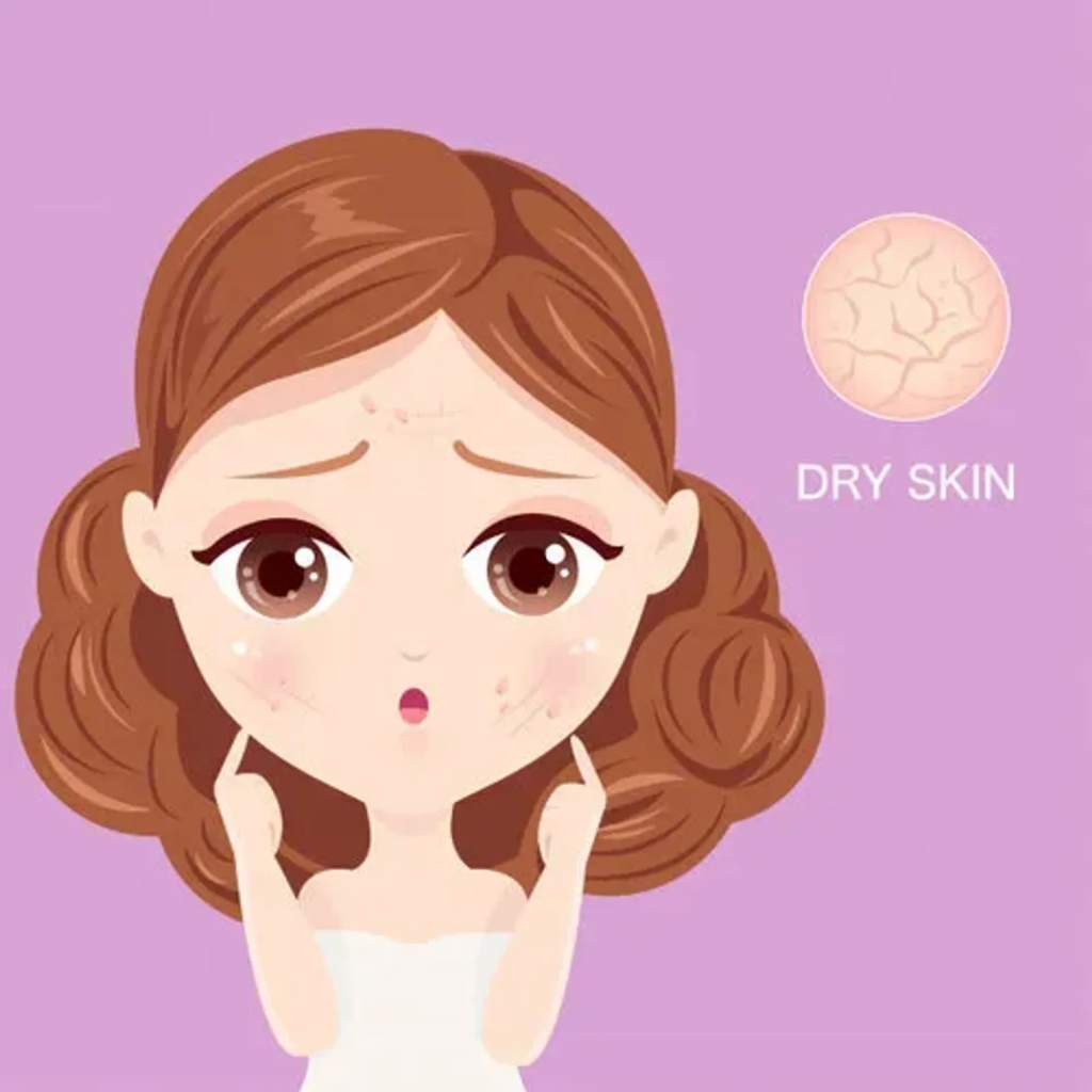 Nguyên nhân gây khô da và cách chăm sóc da khô hiệu quả, an toàn